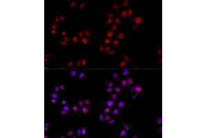 Immunofluorescence analysis of HeLa cells using HMGB1 antibody. (HMGB1 抗体  (AA 100-200))