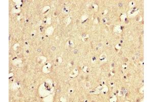 IHC image of ABIN7159059 diluted at 1:300 and staining in paraffin-embedded human brain tissue performed on a Leica BondTM system. (MGP 抗体  (AA 20-96))
