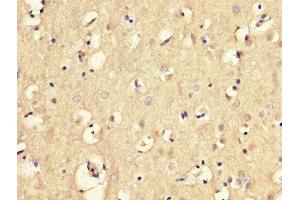 IHC image of ABIN7159059 diluted at 1:300 and staining in paraffin-embedded human brain tissue performed on a Leica BondTM system.