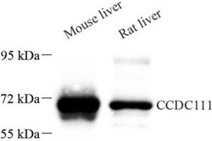 Western blot analysis of CCDC111 (ABIN7073534) at dilution of 1: 500 (CCDC111 抗体)