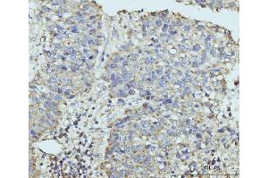 IHC analysis of HUPF2/RENT2/UPF2 using anti-HUPF2/RENT2/UPF2 antibody (ABIN7600567). (RENT2/UPF2 抗体  (AA 200-651))