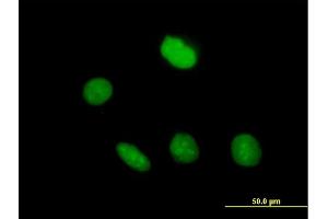 Immunofluorescence of purified MaxPab antibody to ZNF509 on HeLa cell. (ZBTB49 抗体  (AA 1-248))