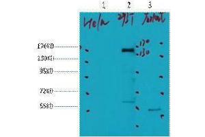 Western Blotting (WB) image for anti-Receptor tyrosine-protein kinase erbB-2 (ErbB2/Her2) antibody (ABIN3181149) (ErbB2/Her2 抗体)