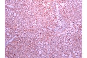 Immunohistochemistry (IHC) image for anti-Solute Carrier Family 5 (Sodium/glucose Cotransporter), Member 1 (SLC5A1) (Internal Region) antibody (ABIN870680)