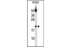 Western blot analysis of SAP18 Antibody (Center) Cat. (SAP18 抗体  (Middle Region))