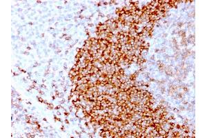 Formalin-fixed, paraffin-embedded human Tonsil stained with CD79b Recombinant Rabbit Monoclonal Antibody (IGB/3170R). (Recombinant CD79b 抗体  (AA 29-159))