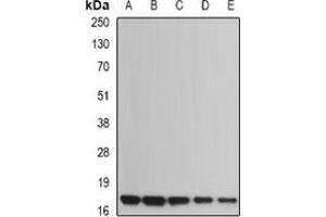 Western blot analysis of UBE2B expression in Jurkat (A), NIH3T3 (B), mouse heart (C), rat heart (D), rat brain (E) whole cell lysates. (UBE2B 抗体)