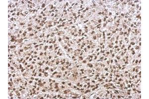 IHC-P Image Immunohistochemical analysis of paraffin-embedded D54 xenograft, using Ku70, antibody at 1:500 dilution.