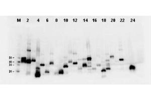 Twenty-four (24) clones were randomly selected and grown up from glycerol stocks by inoculating 0. (DYKDDDDK Tag 抗体)