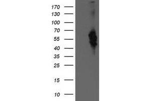Western Blotting (WB) image for anti-Bestrophin 3 (BEST3) antibody (ABIN1501730) (Bestrophin 3 抗体)