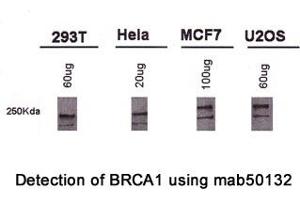 Image no. 1 for anti-Breast Cancer 1 (BRCA1) (AA 1314-1600), (AA 1314-1864) antibody (ABIN363286) (BRCA1 抗体  (AA 1314-1600, AA 1314-1864))