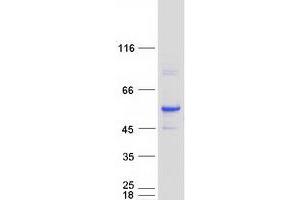 Western Blotting (WB) image for Aldehyde Dehydrogenase 3 Family, Member A2 (ALDH3A2) (Transcript Variant 1) protein (Myc-DYKDDDDK Tag) (ABIN2714545)