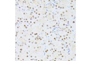Immunohistochemistry of paraffin-embedded rat pancreas using ETV1 antibody (ABIN6291698) at dilution of 1:100 (40x lens). (ETV1 抗体)