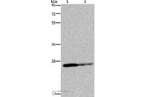 Western blot analysis of HT-29 cell and human fetal brain tissue, using GSTP1 Polyclonal Antibody at dilution of 1:350 (GSTP1 抗体)