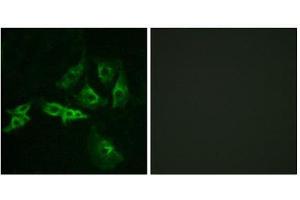 Immunofluorescence (IF) image for anti-Gonadotropin-Releasing Hormone Receptor (GNRHR) (Internal Region) antibody (ABIN1852968) (GNRHR 抗体  (Internal Region))
