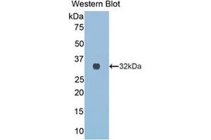 Western blot analysis of the recombinant protein. (COL3A1 抗体  (AA 1171-1435))