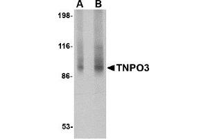 Western Blotting (WB) image for anti-Transportin 3 (TNPO3) (N-Term) antibody (ABIN1031695) (Transportin 3 抗体  (N-Term))