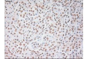 Immunohistochemical staining of paraffin-embedded colon tissue using anti-VEGFmouse monoclonal antibody. (VEGF 抗体  (AA 27-233))