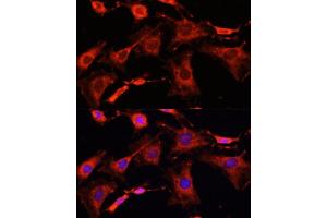 Immunofluorescence analysis of C6 cells using IR antibody (ABIN6130497, ABIN6142514, ABIN6142515 and ABIN6216327) at dilution of 1:100. (IRAK1 抗体  (AA 424-633))