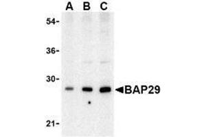 Western blot analysis of Bap29 in human heart tissue lysate with AP30120PU-N Bap29 antibody at (A) 0. (BCAP29 抗体  (Intermediate Domain))