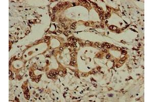 Immunohistochemistry (IHC) image for anti-Eukaryotic Translation Initiation Factor 3, Subunit M (EIF3M) (AA 2-374) antibody (ABIN7152172)