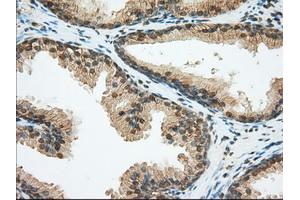 Immunohistochemical staining of paraffin-embedded liver tissue using anti-BSG mouse monoclonal antibody. (CD147 抗体)