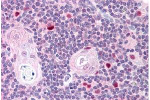 Human Thymus (formalin-fixed, paraffin-embedded) stained with AIRE antibody ABIN293603 at 2. (AIRE 抗体  (AA 102-115))