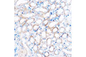 Immunohistochemistry of paraffin-embedded Mouse kidney using PDXP Rabbit pAb (ABIN7269758) at dilution of 1:100 (40x lens). (PDXP 抗体  (C-Term))