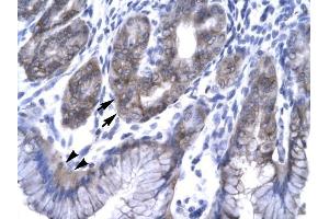 EAP30 antibody was used for immunohistochemistry at a concentration of 4-8 ug/ml to stain EpitheliaI Cells of Fundic Gland (arrows) and Surface Mucous Cells (Indicated with Arrow Heads) in Human Stomach. (SNF8 抗体  (N-Term))