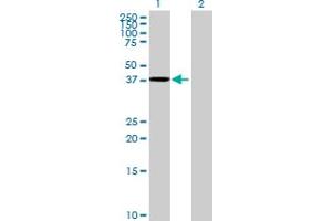 Western Blot analysis of TTLL1 expression in transfected 293T cell line by TTLL1 MaxPab polyclonal antibody. (TTLL1 抗体  (AA 1-423))