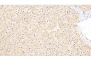 Detection of a2PI in Human Liver Tissue using Polyclonal Antibody to Alpha 2-Antiplasmin (a2PI) (alpha 2 Antiplasmin 抗体)