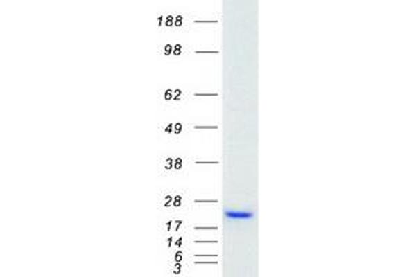 LMO4 Protein (Myc-DYKDDDDK Tag)
