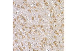 Immunohistochemistry of paraffin-embedded rat brain using IRS1 Rabbit pAb (ABIN3020773, ABIN3020774, ABIN3020775, ABIN1513104 and ABIN6213716) at dilution of 1:150 (40x lens). (IRS1 抗体)