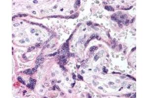 Immunohistochemistry of Rabbit anti-EGFR pY1197 antibody. (EGFR 抗体  (AA 1175-1200))