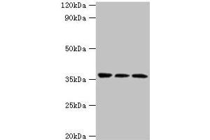 Western blot All lanes: SLAMF7 antibody at 3 μg/mL Lane 1: Jurkat whole cell lysate Lane 2: K562 whole cell lysate Lane 3: Mouse spleen tissue Secondary Goat polyclonal to rabbit IgG at 1/10000 dilution Predicted band size: 38, 26, 18, 33, 23, 22 kDa Observed band size: 38 kDa (SLAMF7 抗体  (AA 23-226))