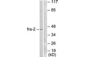 Western Blotting (WB) image for anti-FOS-Like Antigen 2 (FOSL2) (AA 271-320) antibody (ABIN2889199) (FOSL2 抗体  (AA 271-320))