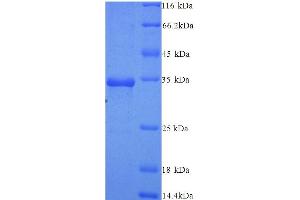 Argonaute 2 (AGO2) (AA 517-818) protein (His tag)