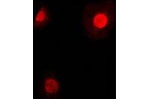 Immunofluorescent analysis of TEAD2 staining in HepG2 cells. (TEAD2 抗体)
