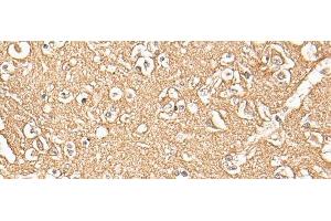 Immunohistochemistry of paraffin-embedded Human brain tissue using ADORA3 Polyclonal Antibody at dilution of 1:30(x200) (Adenosine A3 Receptor 抗体)