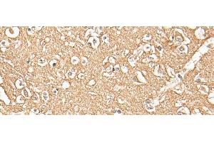 Immunohistochemistry of paraffin-embedded Human brain tissue using ADORA3 Polyclonal Antibody at dilution of 1:30(x200)