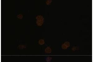 Immunofluorescence analysis of Y79 cells using RCVRN Polyclonal Antibody at dilution of 1:100. (Recoverin 抗体)