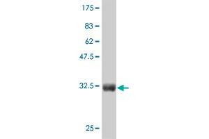 Western Blot detection against Immunogen (36. (CTNNB1 抗体  (AA 682-781))