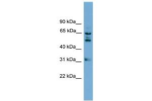WB Suggested Anti-WDR16 Antibody Titration: 0. (WDR16 抗体  (Middle Region))