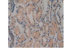 IHC-P analysis of Human Kidney Tissue, with DAB staining. (PLAT 抗体  (AA 311-562))