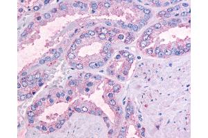 Immunohistochemistry (IHC) image for anti-Olfactory Receptor, Family 51, Subfamily E, Member 1 (OR51E1) (Cytoplasmic Domain) antibody (ABIN1049181)
