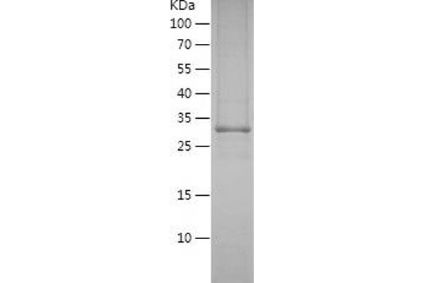 CYP3A4 Protein (AA 244-503) (His tag)