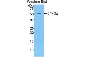 Western blot analysis of the recombinant protein. (BMP1 抗体  (AA 610-843))