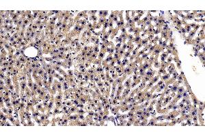 Detection of TXNRD1 in Mouse Liver Tissue using Polyclonal Antibody to Thioredoxin Reductase 1 (TXNRD1) (TXNRD1 抗体  (AA 374-577))