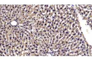 Detection of TXNRD1 in Mouse Liver Tissue using Polyclonal Antibody to Thioredoxin Reductase 1 (TXNRD1) (TXNRD1 抗体  (AA 374-577))