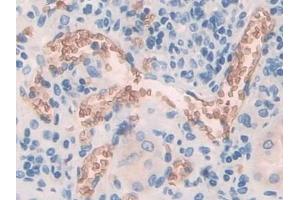 Immunohistochemistry (IHC) image for anti-Solute Carrier Family 4, Anion Exchanger, Member 1 (erythrocyte Membrane Protein Band 3, Diego Blood Group) (SLC4A1) (AA 35-290) antibody (ABIN7441895)